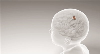 耀世：首例脑机接口设备人体移植完成